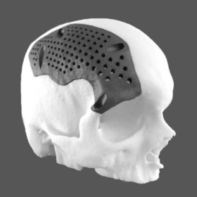 3D Skull